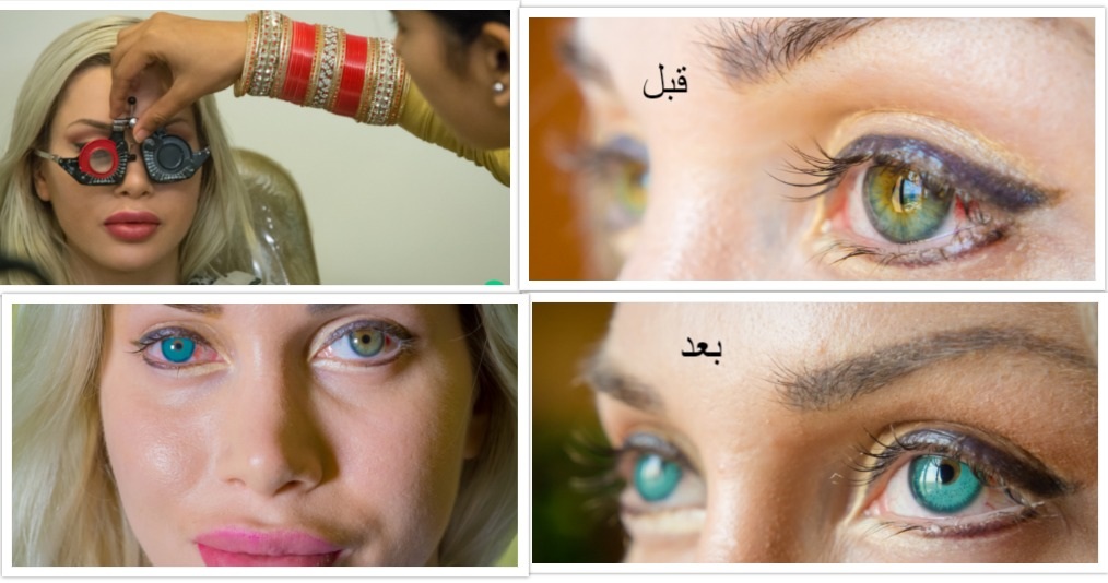 العلاج في الهند 